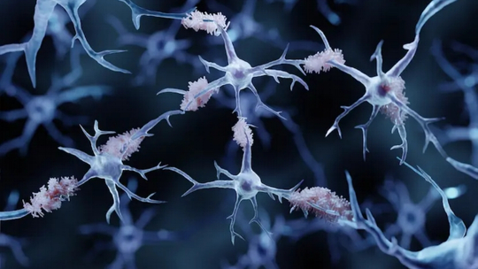 Potential Implication of Treatment for Alzheimer’s Disease: Current and Future