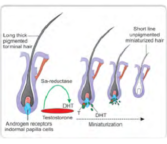 Pengaruh DHT pada Folikel Rambut