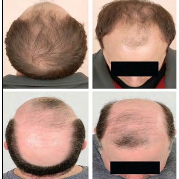 Pola Khas AAG pada Pria