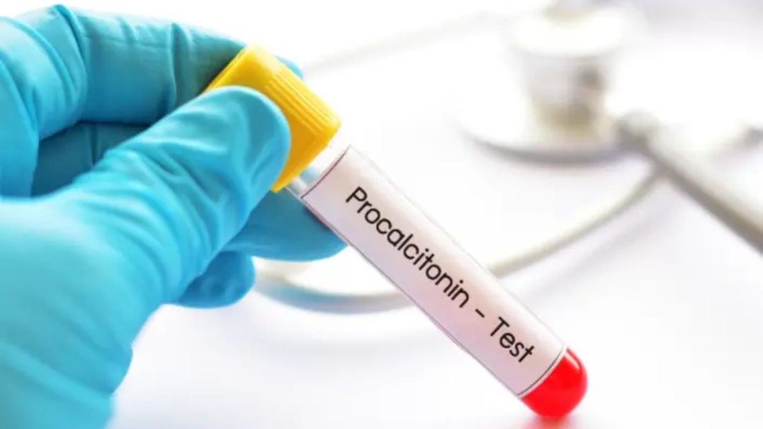 Peran Procalcitonin Sebagai Marker Infeksi