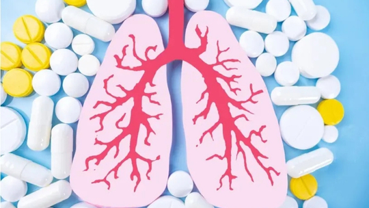 Kenali dan Atasi Efek Samping Obat Antituberkulosis (OAT) Kenali dan Atasi Efek Samping Obat Antituberkulosis (OAT)